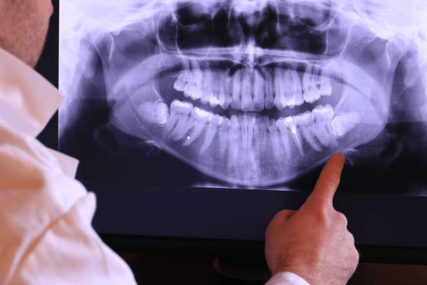 Best Emergency Dentist for Knocked-Out Tooth in Woodmere, NY